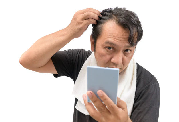 man showing Hair Thinning