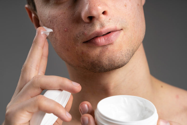 What Is Cystic Acne and How Is It Treated? 